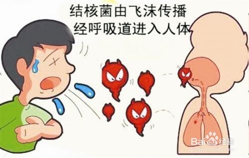 如何預(yù)防肺結(jié)核？